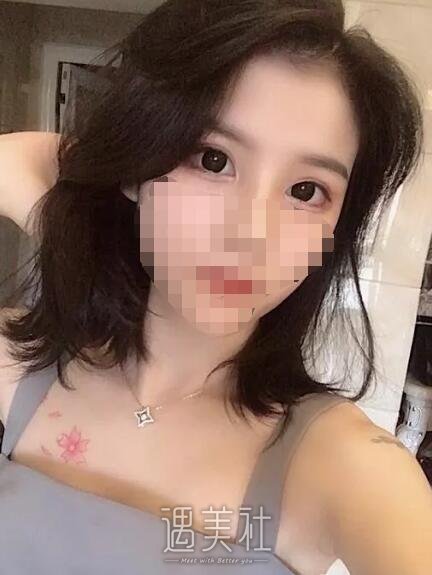 侯亚杰做双眼皮怎么样?有他近期的双眼皮案例看看吗?
