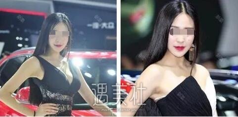 首尔丽格洪性范长曲线下颌角整形案例：恋上现在的我!