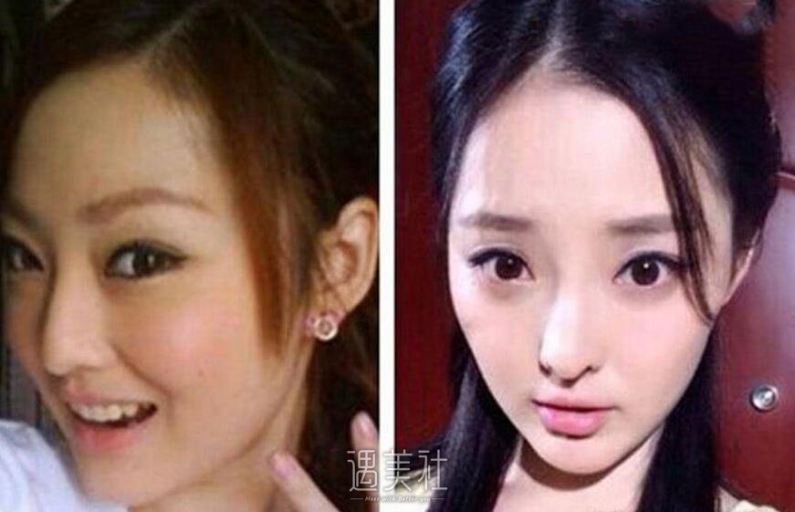 王洁曦整容前后照片慢慢传开了，整容前还是大家的女神吗?