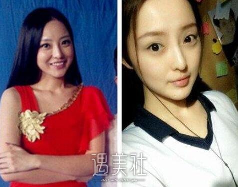 王洁曦整容前后照片慢慢传开了，整容前还是大家的女神吗?
