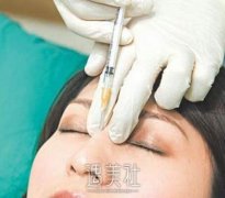 切双眼皮手术和恢复过程分享：我真的对目前果很满意! width=