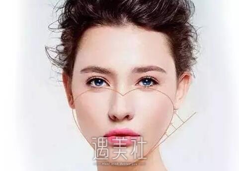 双下巴手术
