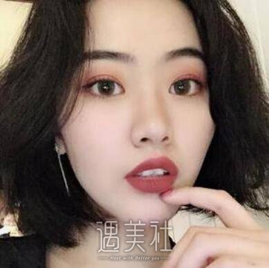 朴相根,韩式大眼