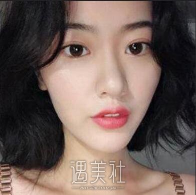 朴相根,韩式大眼