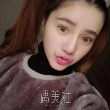 林伟亮