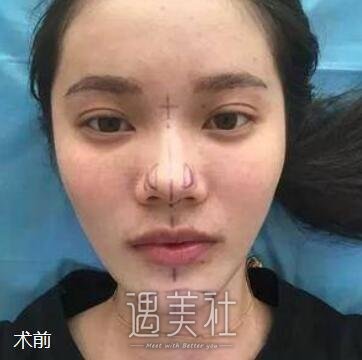 林伟亮