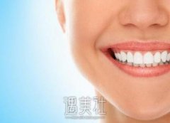 全瓷牙贴面能撑多久|全瓷牙贴面一般可以管多少年呢？ width=