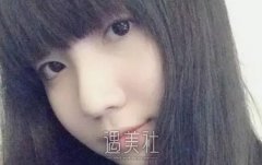 九院金云波双眼皮真实案例分享，看看她的变美历程! width=