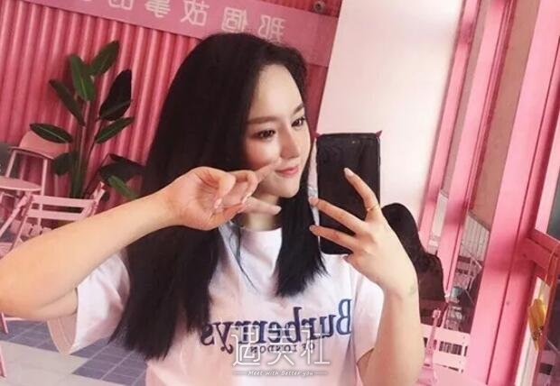 九院王炜隆鼻真实案例分享~前后变化确实很大!