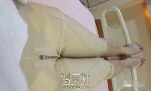 九院余力吸脂案例展示，看看他的技术是否真的这么强!