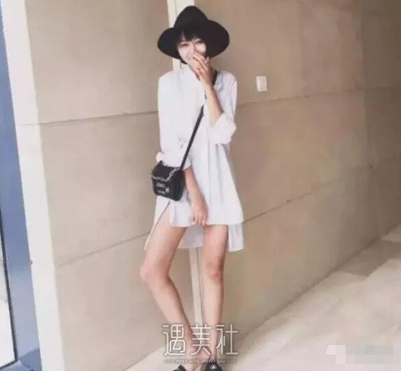 九院余力吸脂案例展示，看看他的技术是否真的这么强!