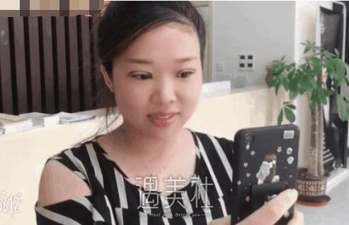 祝联双眼皮真实案例分享，看看小眼睛是如何逆袭的!