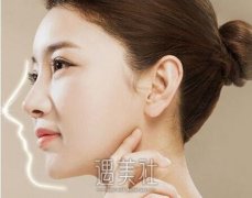 唐山垫鼻子大概需要多少钱?价格在啥区间比较合理呢? width=