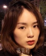 首尔丽格崔荣达v-line颌面手术案例：从此拥有瓜子脸~ width=