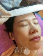 像素激光去疤果图分享——来自像素激光去疤案例一篇~ width=