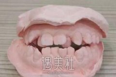 徐洪森擅长做什么项目呢？有徐洪森医生真实案例吗？ width=