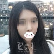 首尔丽格崔荣达面部不对称矫正案例：精致小脸从此诞生！ width=