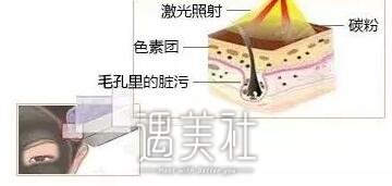 黑脸娃娃