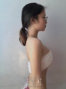 曹卫刚自体脂肪隆胸案例：软软的超自然 width=