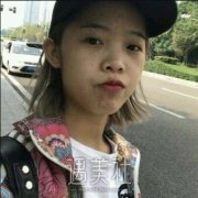 李青峰隆鼻案例：四个月获得自然款鼻子 width=