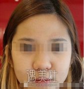 高培培医生技术过关吗?有高培培近期案例展示吗? width=