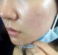 黑脸娃娃有吗?刚做了黑脸娃娃的我很有发言权喃! width=