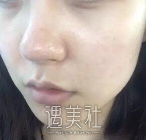 黑脸娃娃有吗?刚做了黑脸娃娃的我很有发言权喃!
