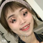 张富强正牙靠谱吗——上月初刚找张医生做了牙齿矫正呢~ width=
