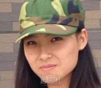 自体脂肪填充法令纹果怎么样?我用亲身经历来回答一下~ width=