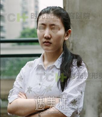重庆,时光,隆鼻