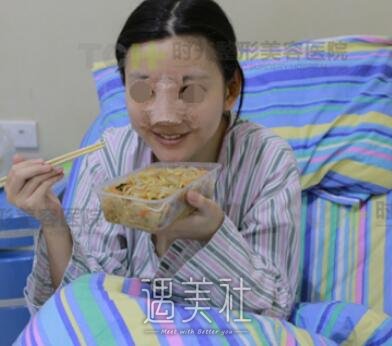 重庆,时光,隆鼻