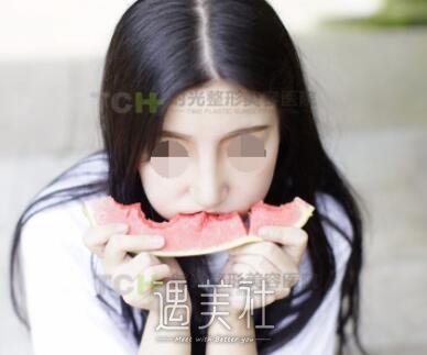 重庆,时光,隆鼻