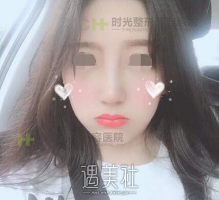 重庆,时光,隆鼻