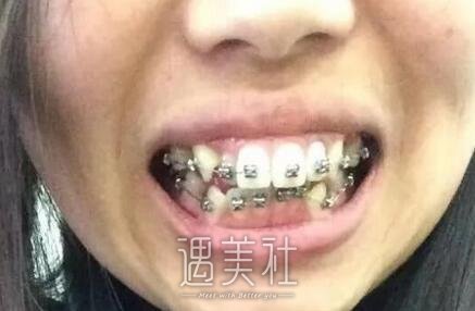 周显峰