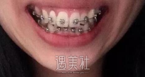 周显峰