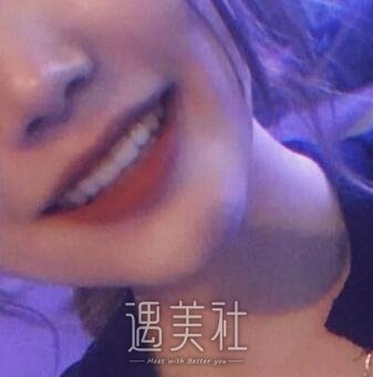 周显峰