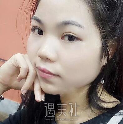 周一雄,双眼皮
