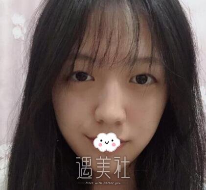 赵耀忠,双眼皮