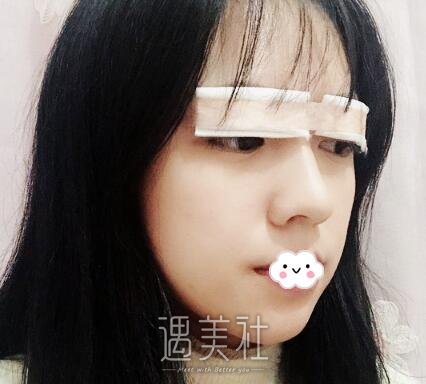 赵耀忠,双眼皮