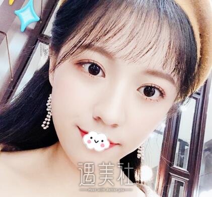 赵耀忠,双眼皮