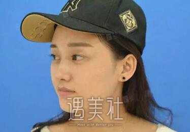 徐剑炜,双眼皮