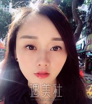 徐剑炜,双眼皮