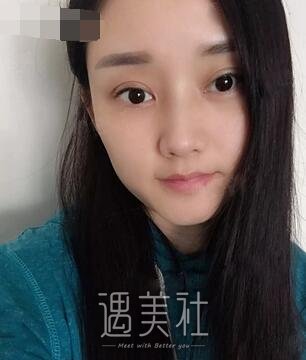 徐剑炜,双眼皮