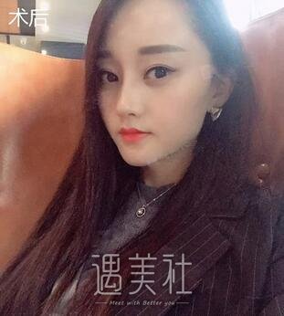 徐剑炜,双眼皮