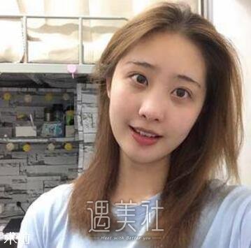 吴包金,切痣