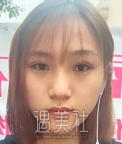 施悦,双眼皮
