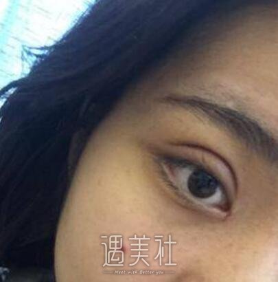 李圣利,双眼皮