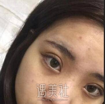 李圣利,双眼皮