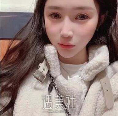 九院,催海燕,隆鼻