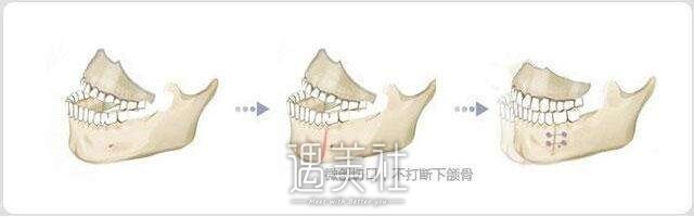 正牙专家侯振杰技术很好嘛|侯振杰医生个人资料更新啦~